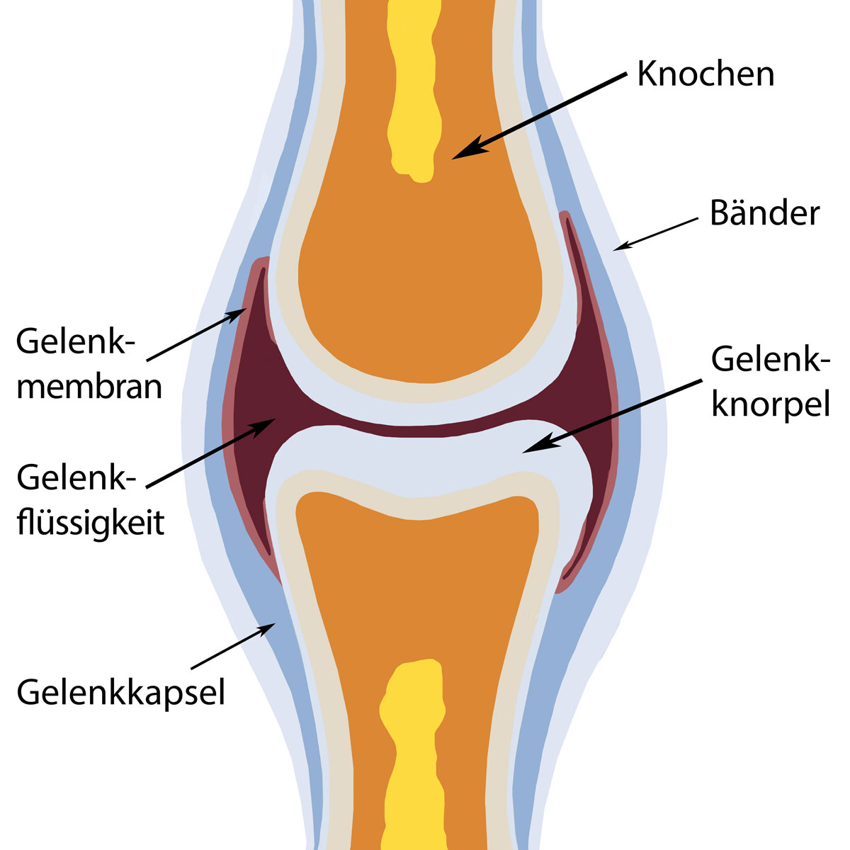 Aufbau-Gelenk